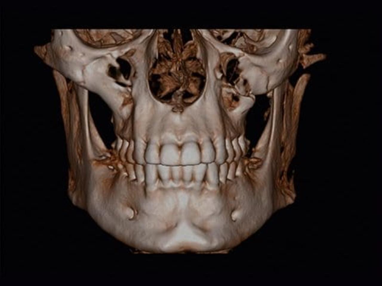 CBCT Interpretation Cavendish Imaging