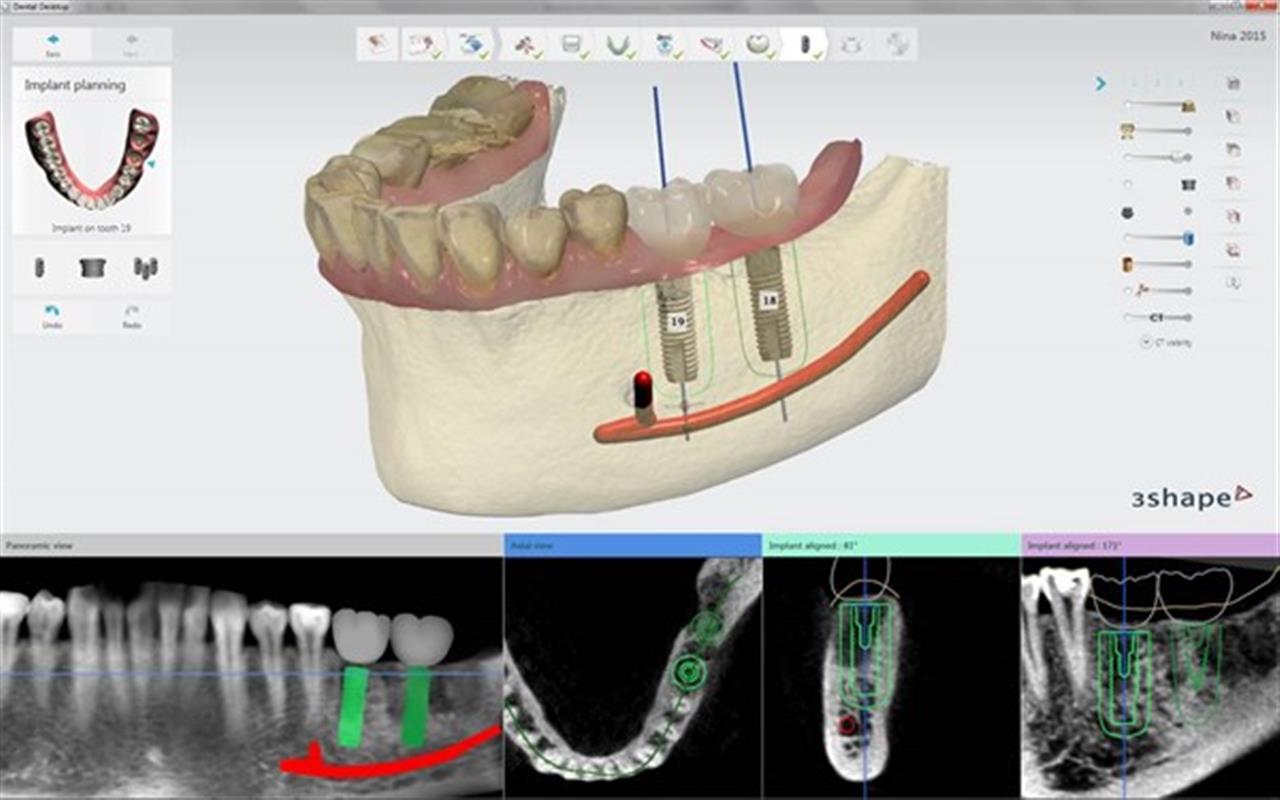 Guided Surgery for Beginners | Cavendish Imaging