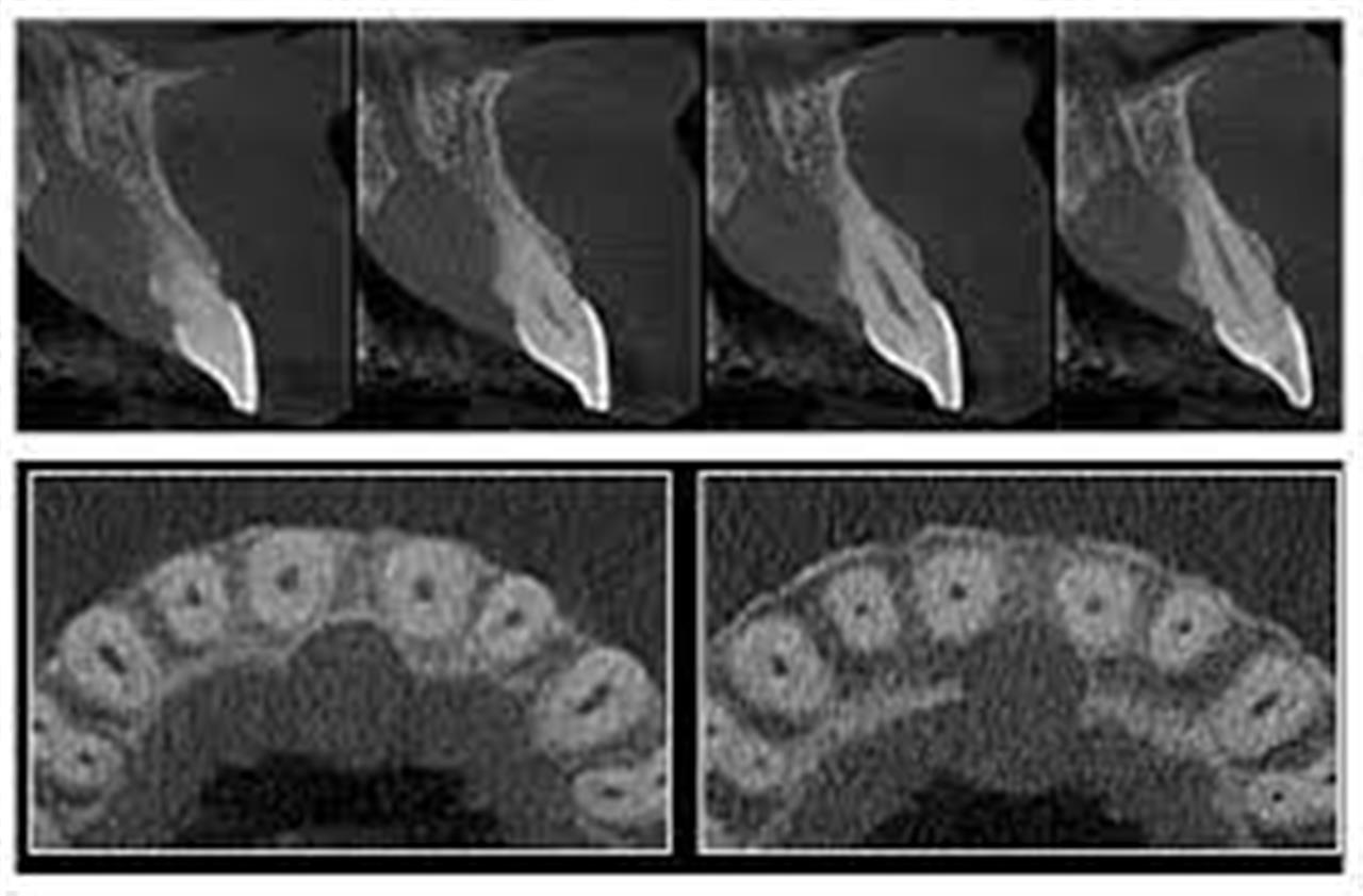 Dental CBCT Interpretation Diseased Anatomy Cavendish Imaging