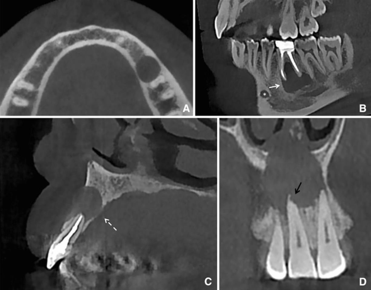 CBCT Interpretation of Diseased Anatomy Cavendish Imaging